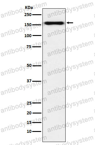 Anti-DSG2 Antibody (R2F20)