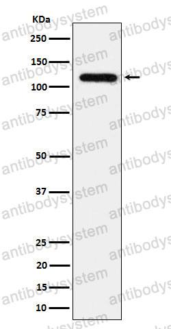 Anti-UBE4A Antibody (R2F22)