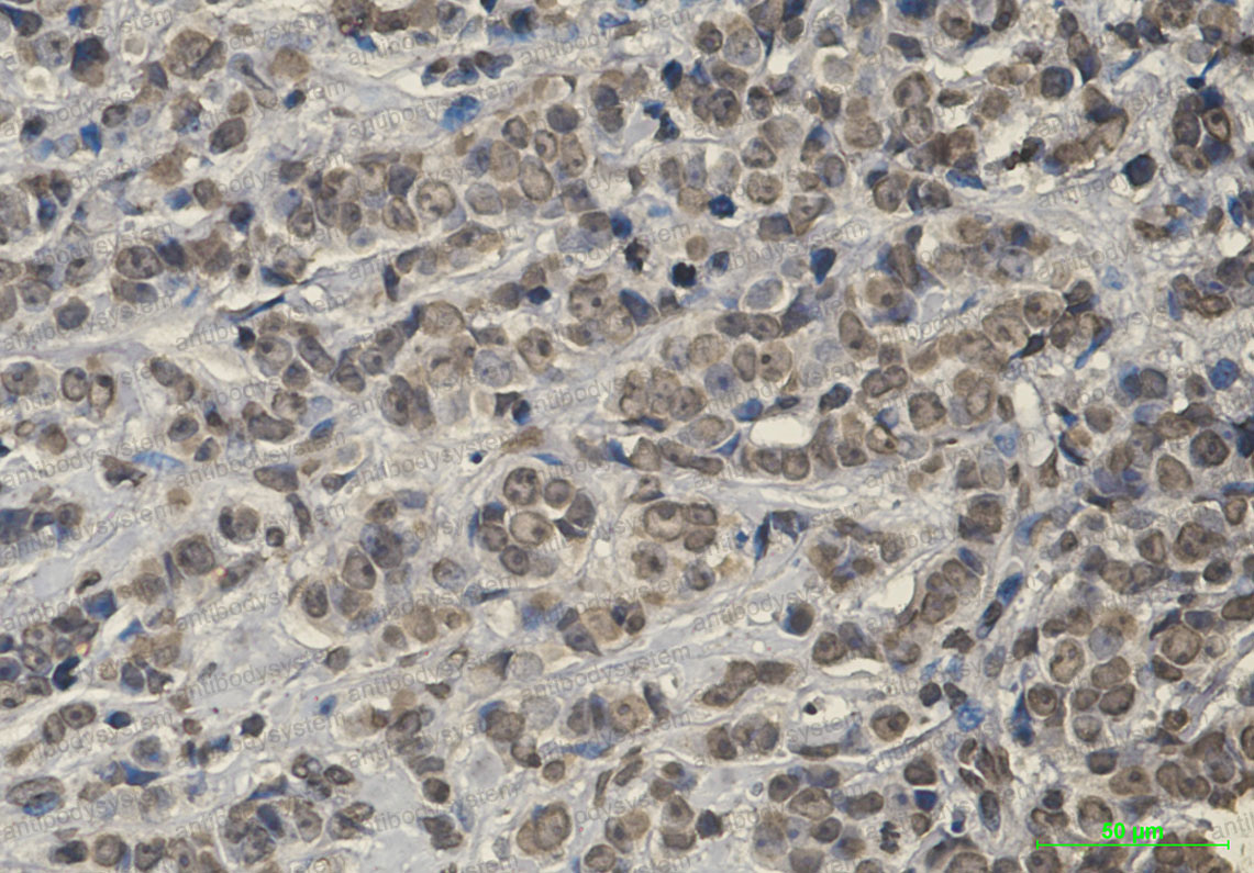 Anti-KEAP1 Antibody (R2F23)