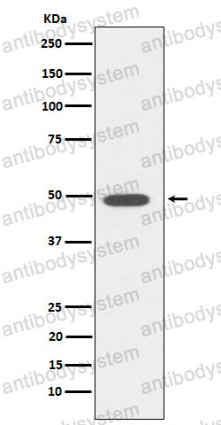 Anti-TFDP1 Antibody (R2F24)