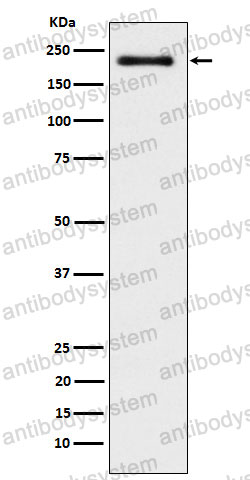 Anti-WRN Antibody (R2F25)