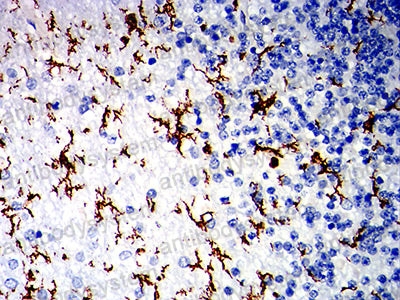 Immunohistochemical for Anti-CD162/SELPLG/PSGL-1 Antibody (R3T15) ?>