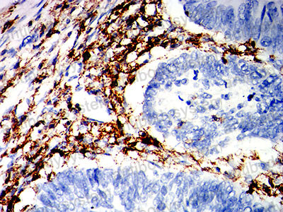 Immunohistochemical for Anti-CD162/SELPLG/PSGL-1 Antibody (R3T15) ?>