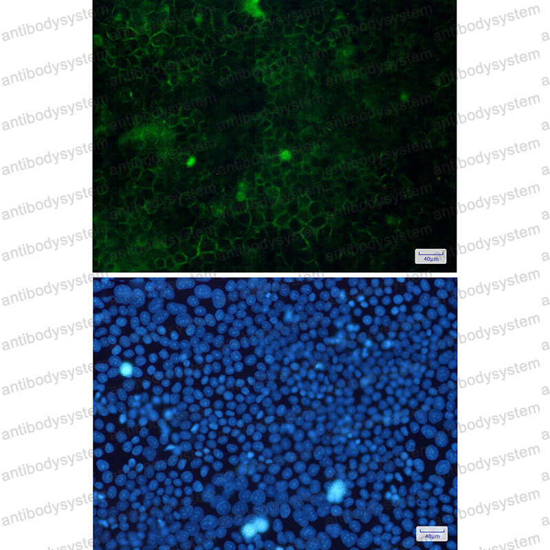 Anti-CTTN Antibody (R2F31)