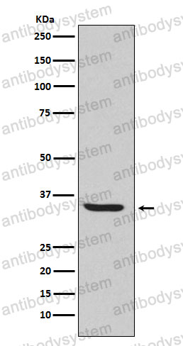 Anti-ENDOG Antibody (R2F32)