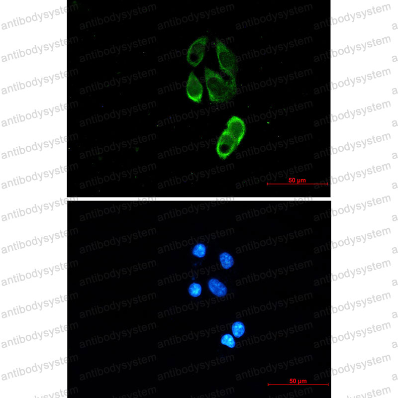 Anti-TRIM25 Antibody (R2F33)
