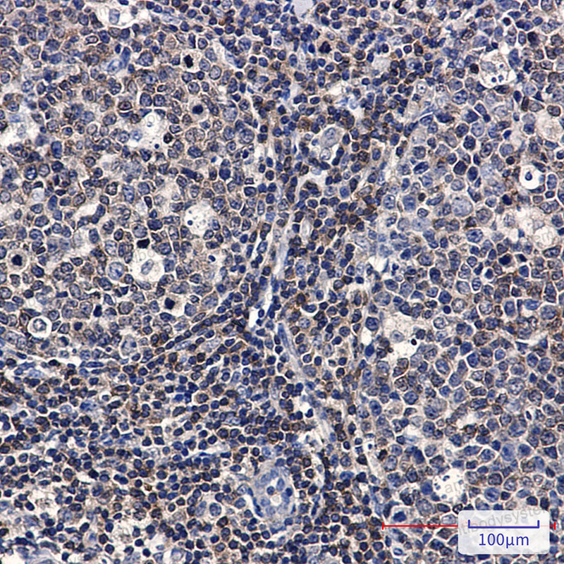 Anti-PTK2B/PYK2 Antibody (R2F34)