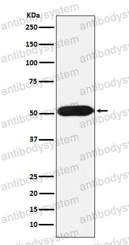 Anti-FKBP8 Antibody (R2F35)