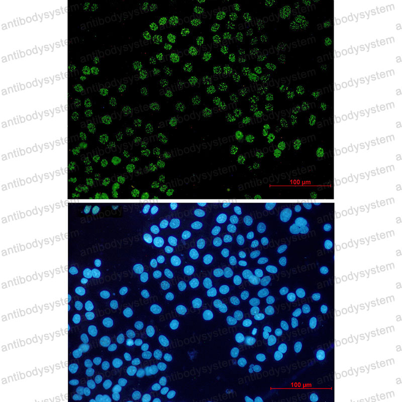 Anti-FAM50A Antibody (R2F37)