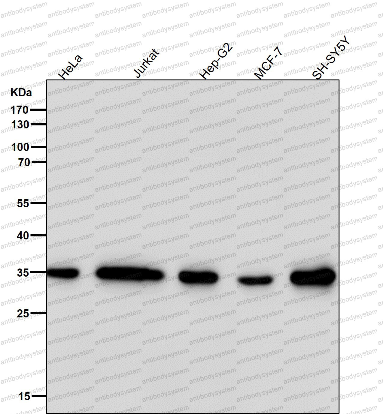 Anti-FRG1 Antibody (R2F38)
