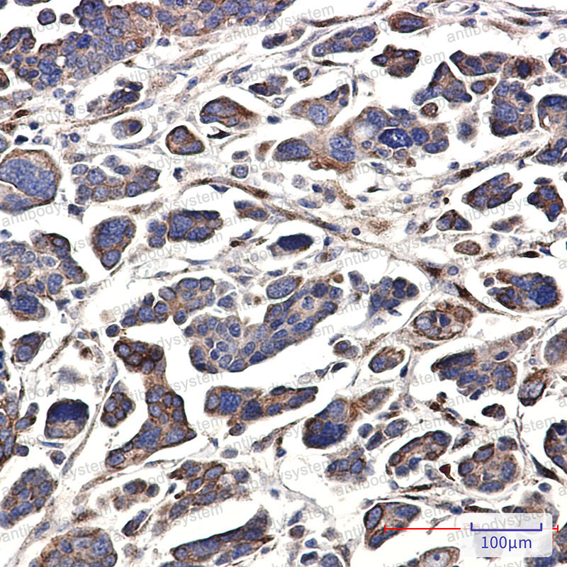 Anti-GNA13 Antibody (R2F40)