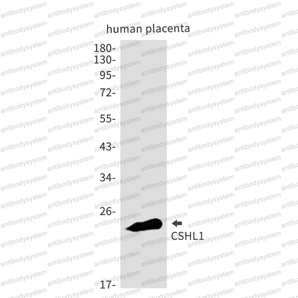 Anti-CSHL1 Antibody (R2F41)