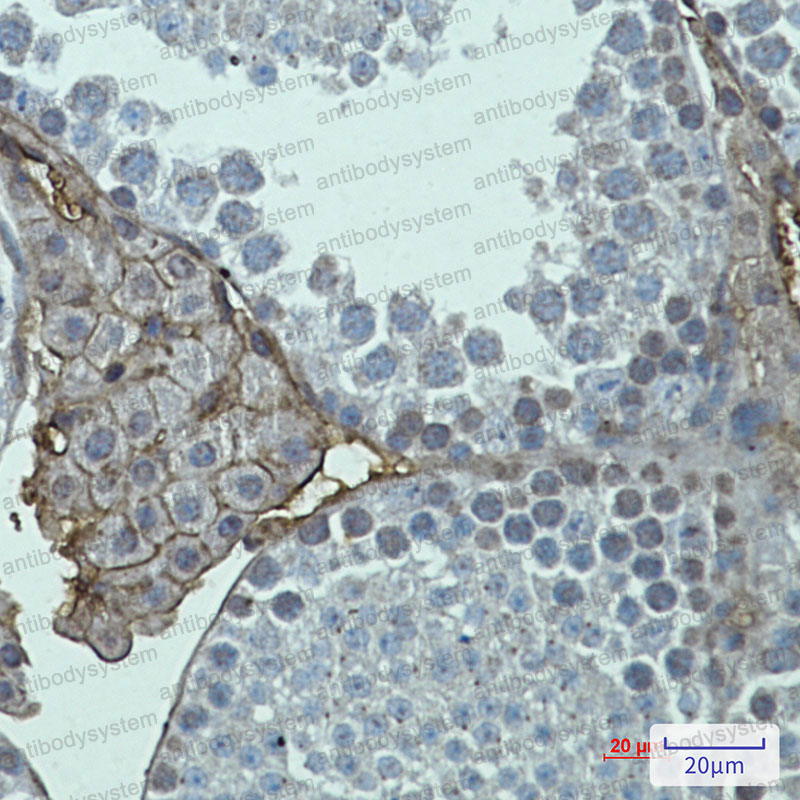 Anti-GRM2 Antibody (R2F42)
