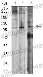 Western blot for Anti-GRM2 Antibody (R3T22) ?>