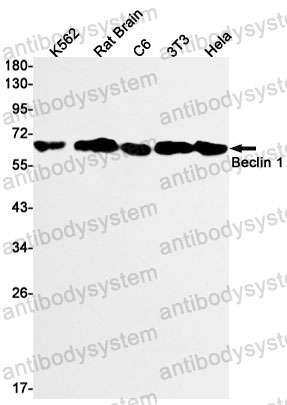 Anti-BECN1 Antibody (R2F44)