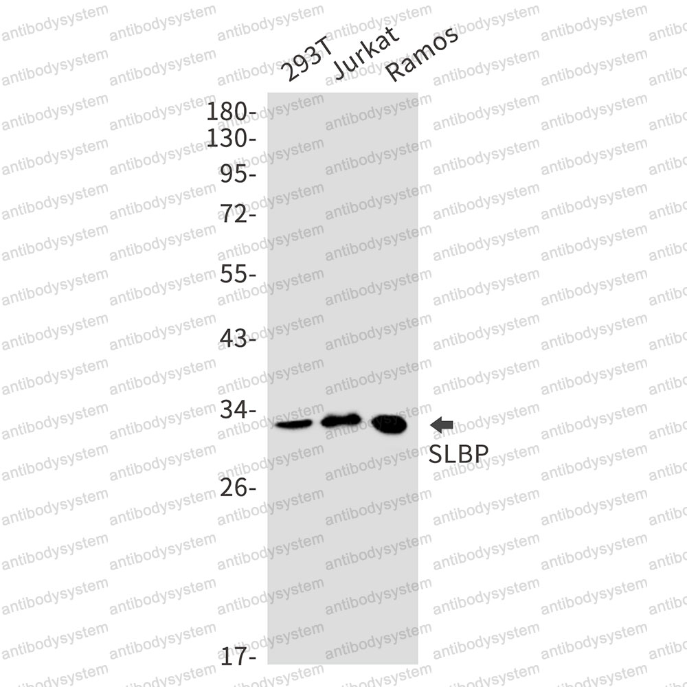 Anti-SLBP Antibody (R2F46)