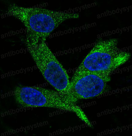 Anti-WFDC2/WAP5 Antibody (R2F47)
