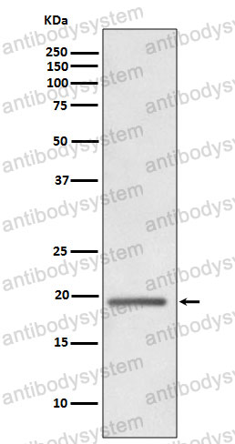 Anti-WFDC2/WAP5 Antibody (R2F48)
