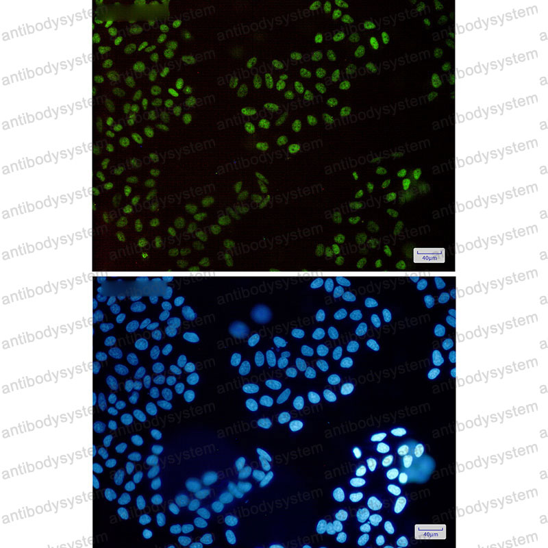 Anti-HLTF Antibody (R2F50)