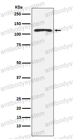 Anti-HLTF Antibody (R2F49)