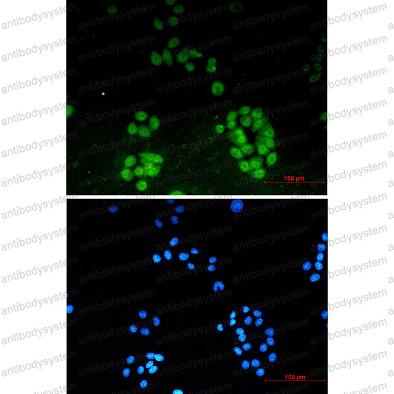 Anti-ENT2/SLC29A2 Antibody (R2F52)