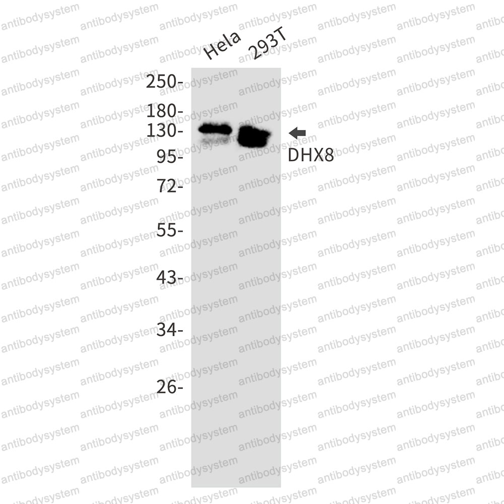 Anti-DHX8 Antibody (R2F53)