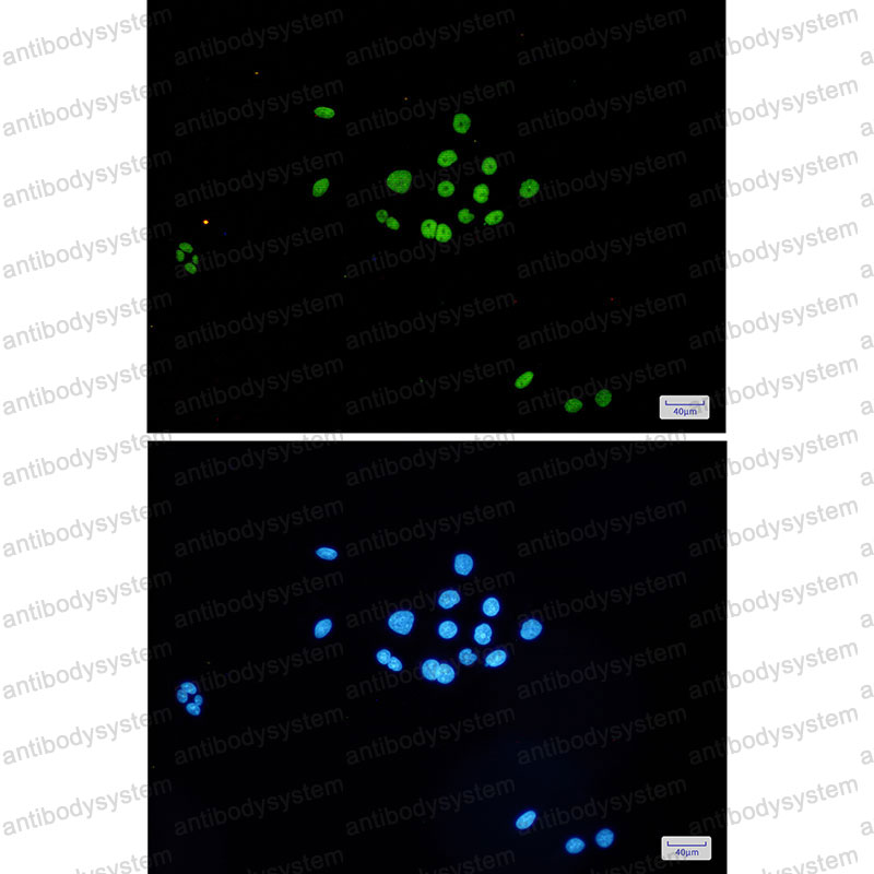 Anti-MCM6 Antibody (R2F55)