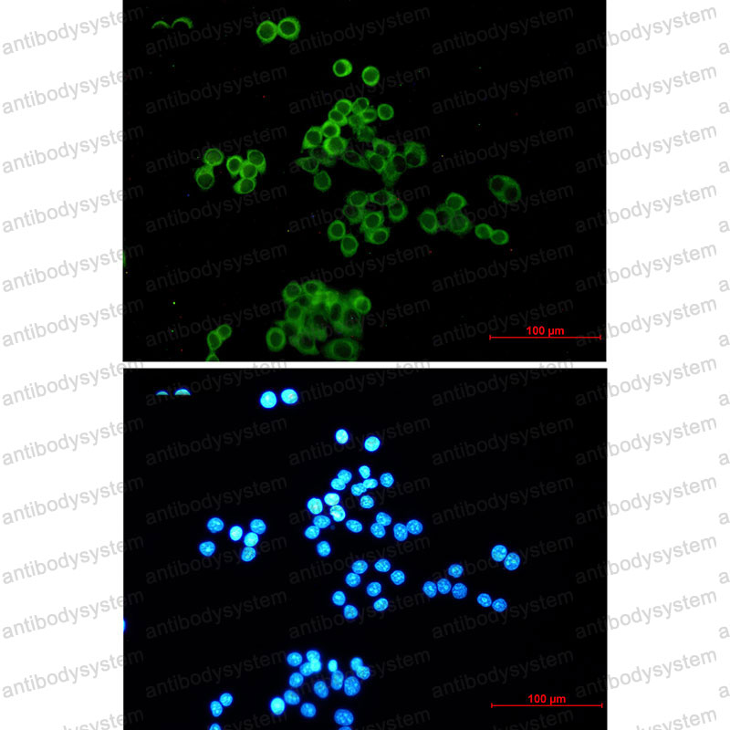 Anti-DSC3 Antibody (R2F57)