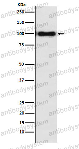 Anti-DSC3 Antibody (R2F56)