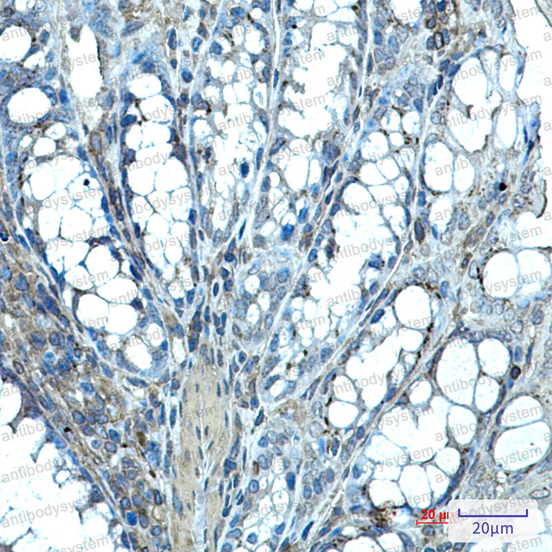Anti-IHH Antibody (R2F59)
