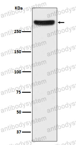 Anti-ITPR1 Antibody (R2F62)