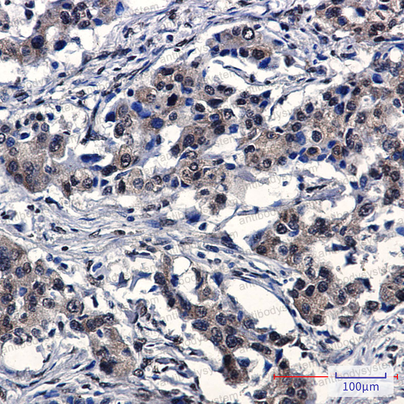 Anti-IRF3 Antibody (R2F63)