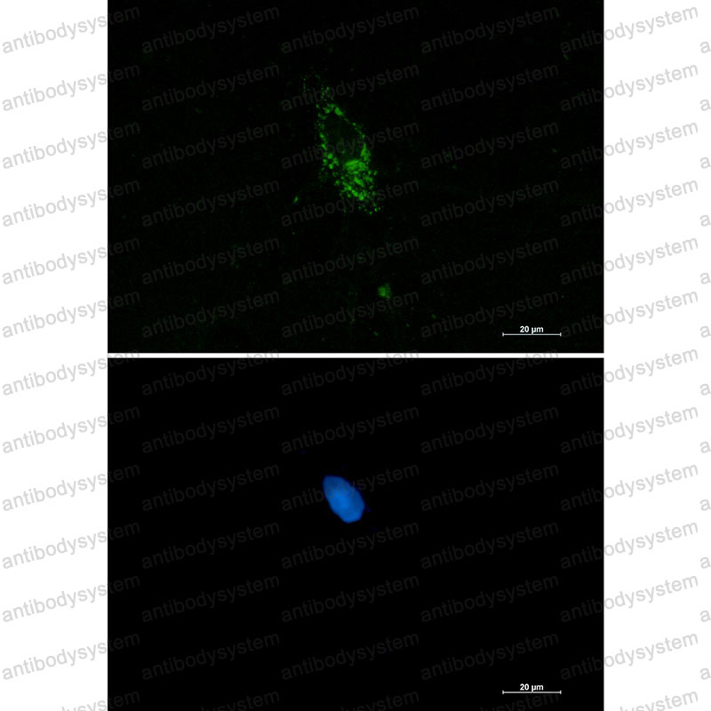 Anti-PUM1 Antibody (R2F65)