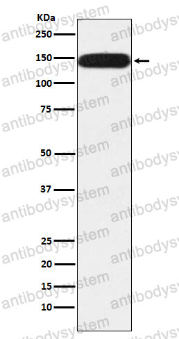 Anti-PUM1 Antibody (R2F64)