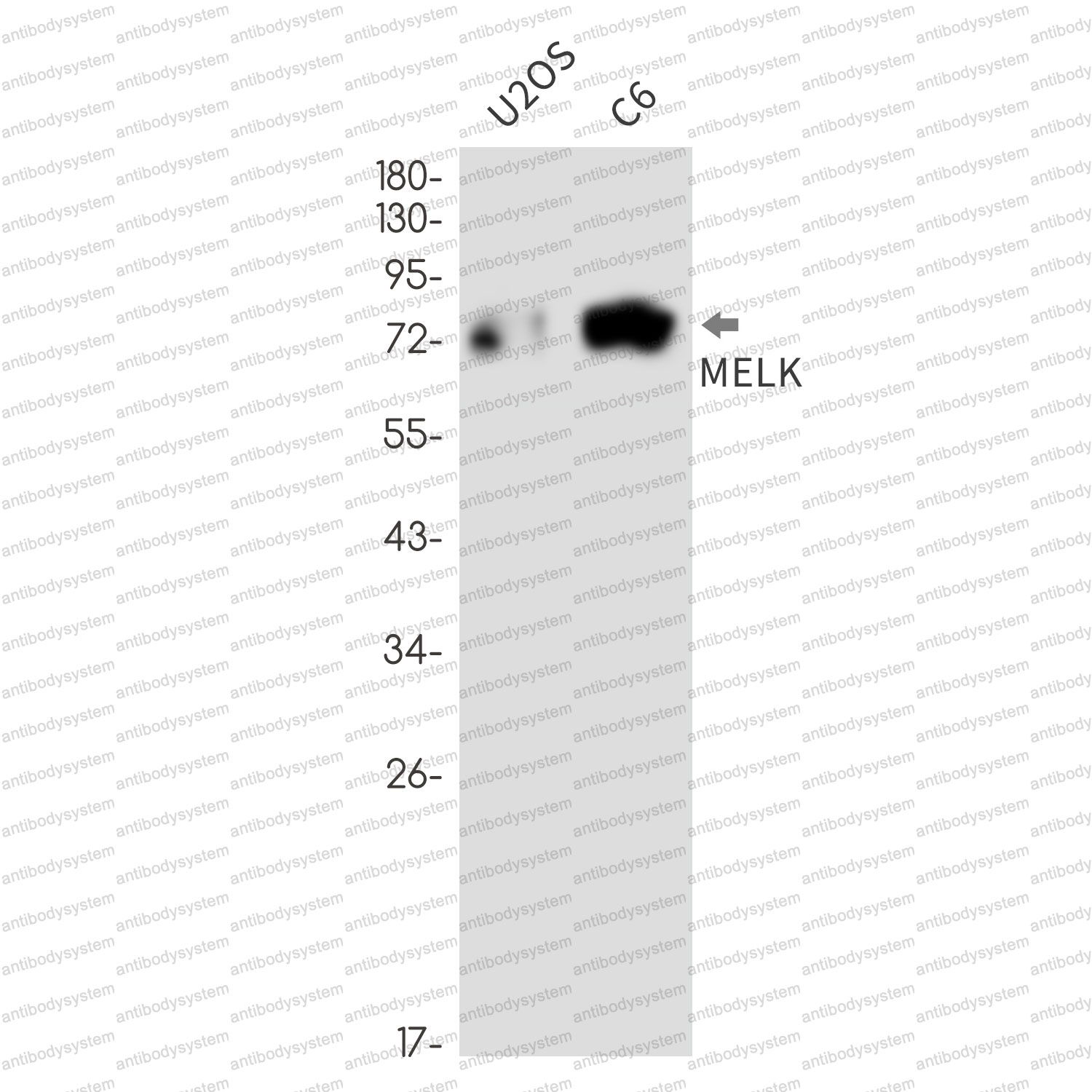 Anti-MELK Antibody (R2F66)
