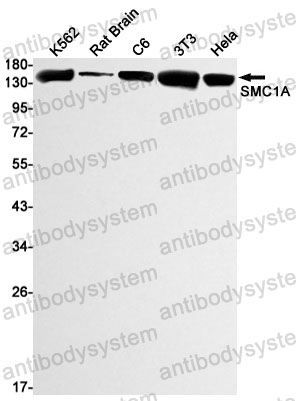 Anti-SMC1A Antibody (R2F67)
