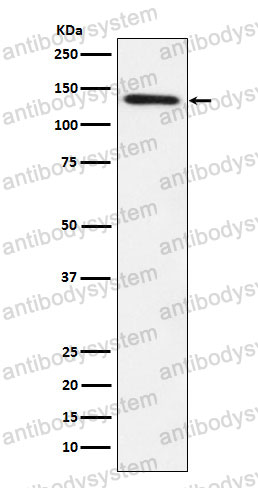 Anti-LPIN1 Antibody (R2F69)