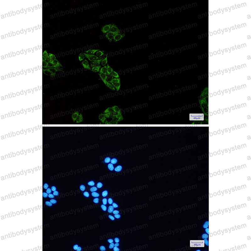 Anti-USP10 Antibody (R2F71)