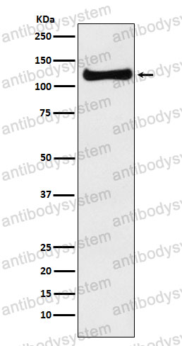 Anti-USP10 Antibody (R2F70)
