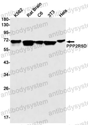 Anti-PPP2R5D Antibody (R2F73)