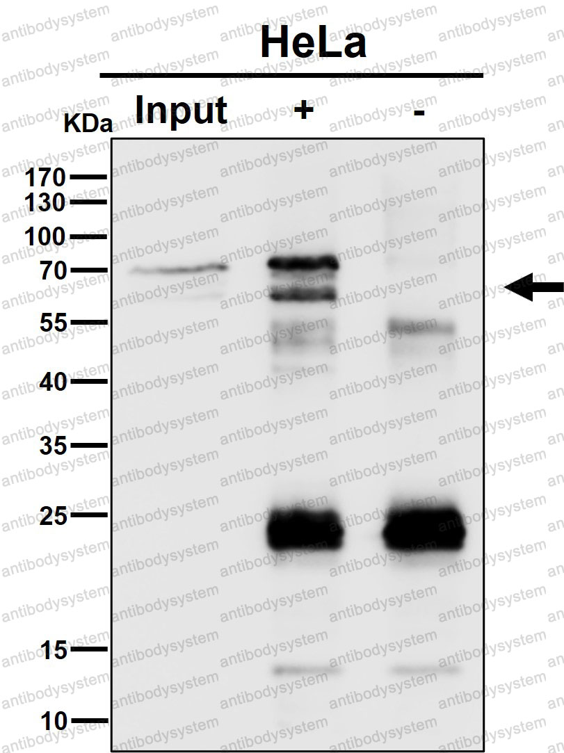 Anti-PPP2R5D Antibody (R2F72)