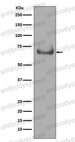 Anti-LBR Antibody (R1C51)
