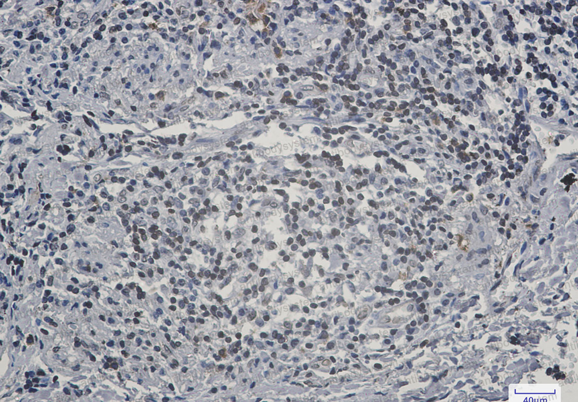 Anti-LBR Antibody (R2F74)