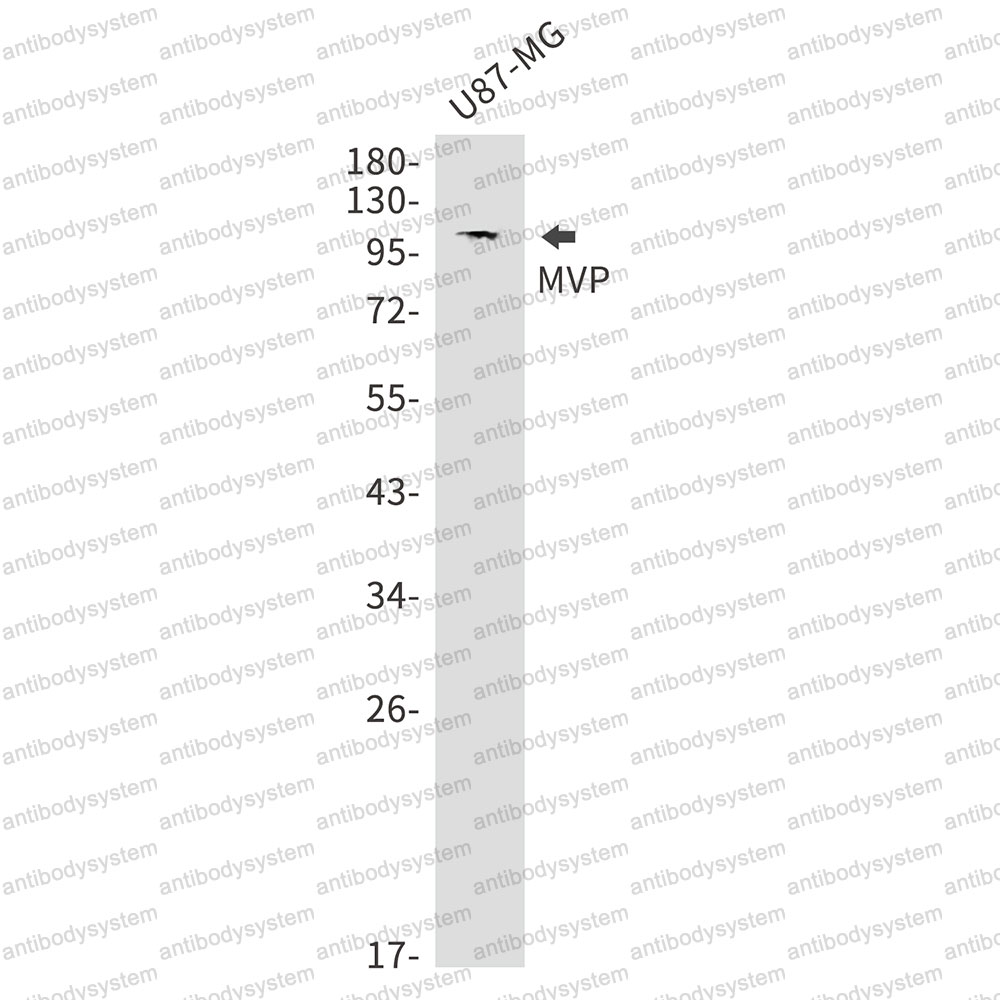 Anti-MVP Antibody (R2F76)