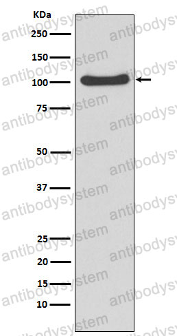Anti-MVP Antibody (R2F75)