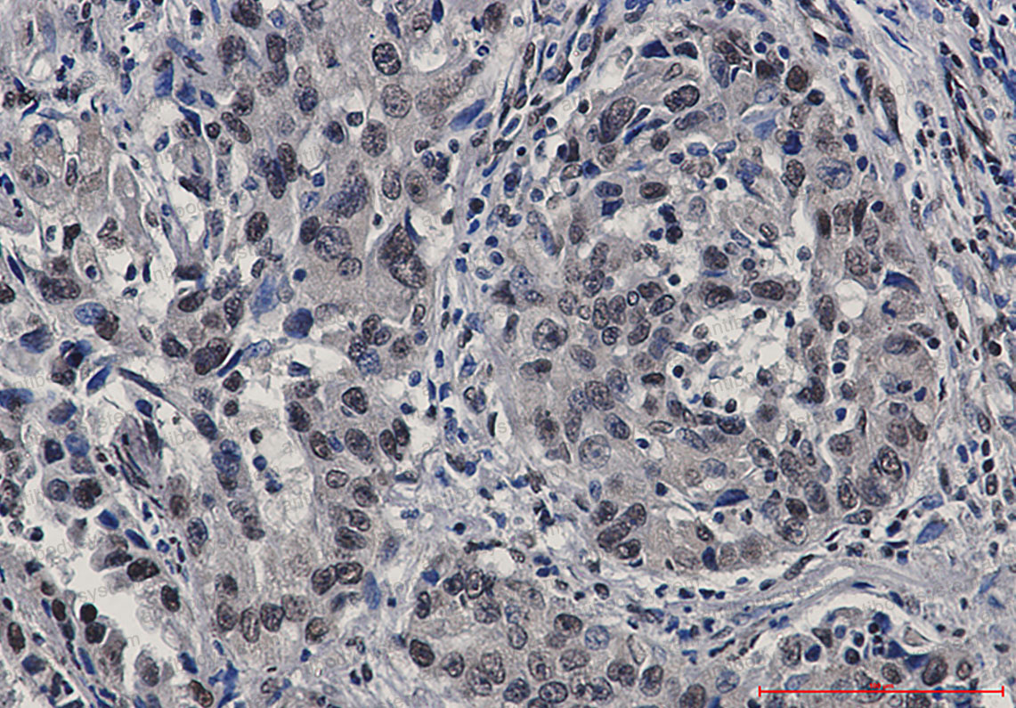 Anti-STAT4 Antibody (R2F78)