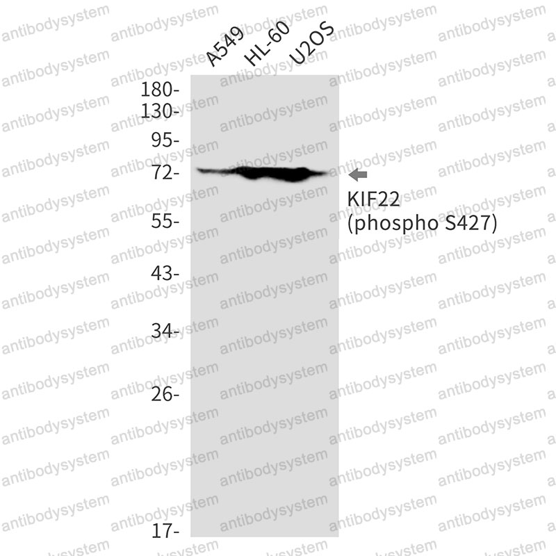 Anti-Phospho-KIF22 (Ser427) Antibody (R2F80)