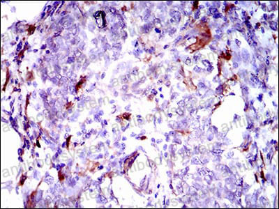 Immunohistochemical for Anti-GPNMB Antibody (R3T41) ?>