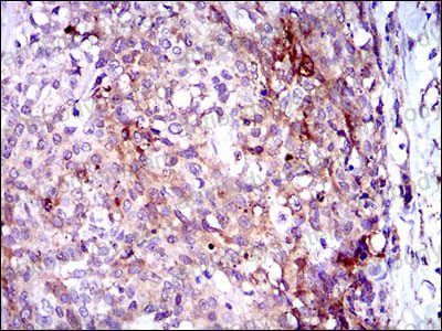 Immunohistochemical for Anti-GPNMB Antibody (R3T41) ?>