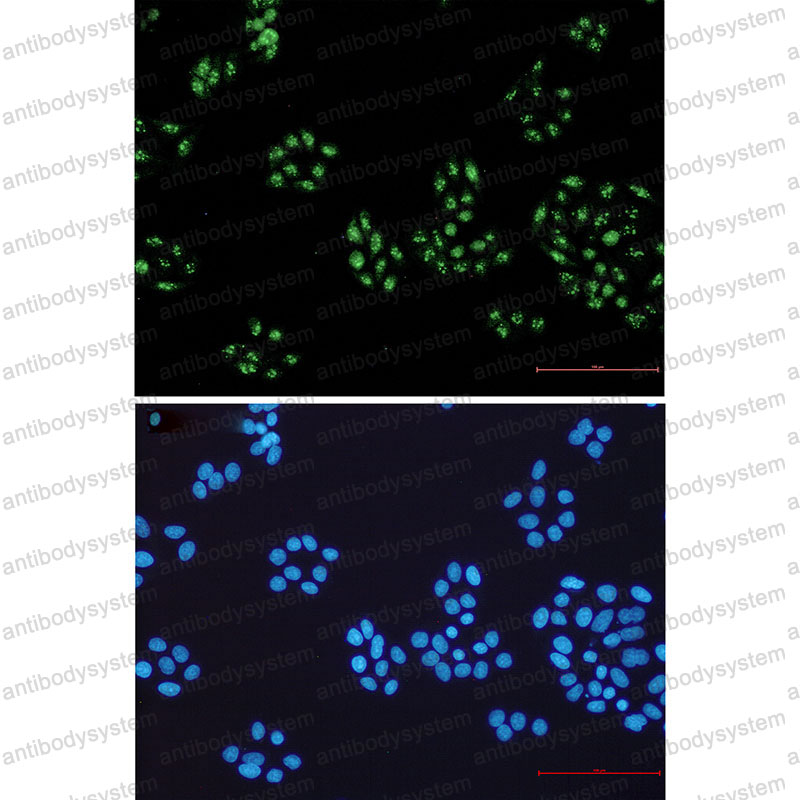 Anti-NOLC1 Antibody (R2F82)